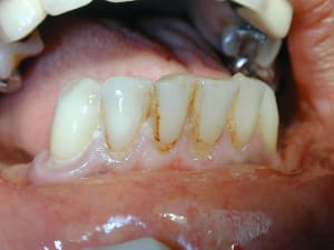 2009 11 20 4 s6oexp - Eugenol