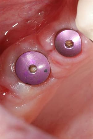 2010 02 19 016 qmcg5z - Eugenol