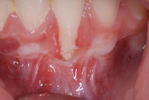 2010 09 30 001 oeu9mz - Eugenol