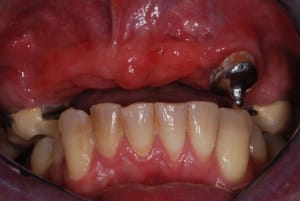 2010 12 14 012 tz0vz0 - Eugenol