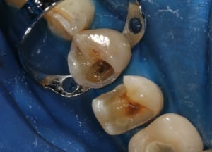 2010 04 22 0180rw tx9cno - Eugenol