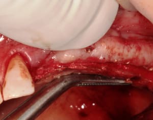 2010 05 28 0509w ssqf0y - Eugenol