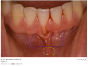 2011 08 22 123833 kojt0u - Eugenol