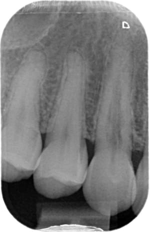 2011 12 05  z00x6v - Eugenol