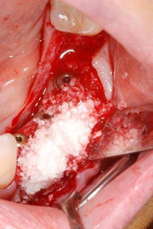 2012 03 02 004 mn4bnj - Eugenol