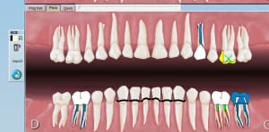 2018 03 05 120724 rznfkr - Eugenol