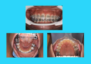 20 jel5co - Eugenol