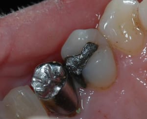 24 gradia avt u1e9fb - Eugenol