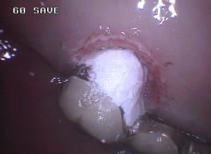 242 zmtbir - Eugenol