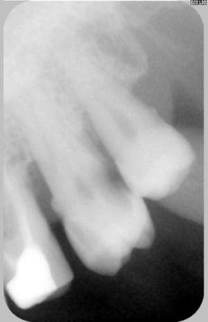 26 mbbrpr - Eugenol