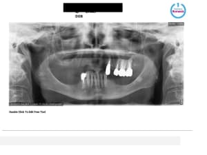 26mmbkpyb7lneybjuv3iv56o8ku0 - Eugenol