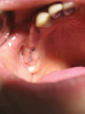 27juillet06 ttza9n - Eugenol