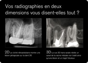 2d vs 3d fr x23tlz - Eugenol