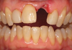 2  large  ky6zkq - Eugenol