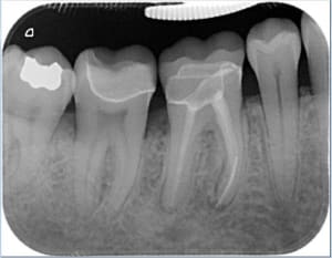 2 ans p o d4mgb4 - Eugenol