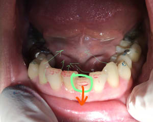 2 junior 1 wcdhzr - Eugenol