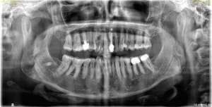 2gd877yzyywxwctxn24rudhyt525 - Eugenol