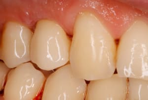 2sknaz8hsh3s8c6ogukxzci7vkbs - Eugenol