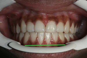 31 copie lklevy - Eugenol