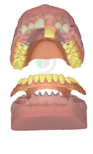 3dscreenshot100 pkvrvg - Eugenol