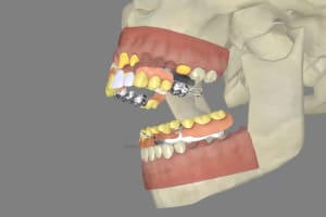 3dscreenshot102 ogsoe6 - Eugenol