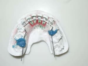 3 wire and bracket fkp0xx - Eugenol