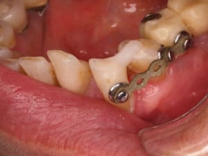 3  2  cuaut9 - Eugenol