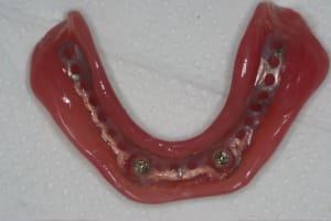 3 oszbon - Eugenol