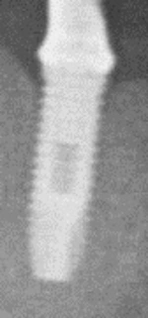 3 uuvfgd - Eugenol