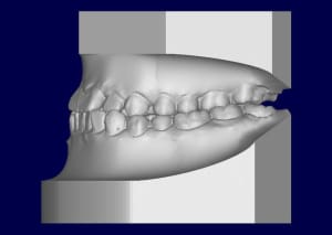 3 vj5oon - Eugenol