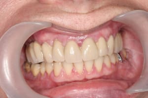3mois1 j95dlm - Eugenol