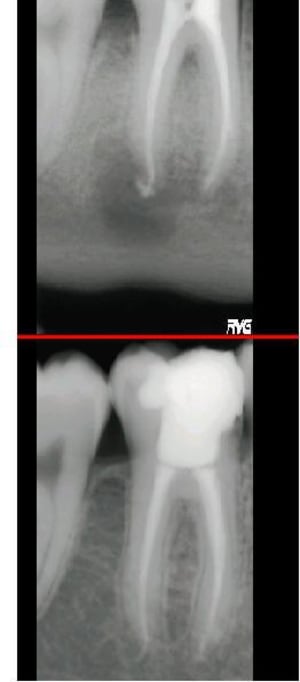 46 avt ap dayn4c - Eugenol
