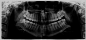 48 opg xuloc4 - Eugenol