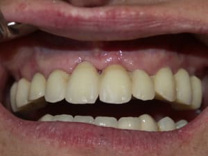 4 cas clinique dr l audibert pamiers  apqyq2 - Eugenol