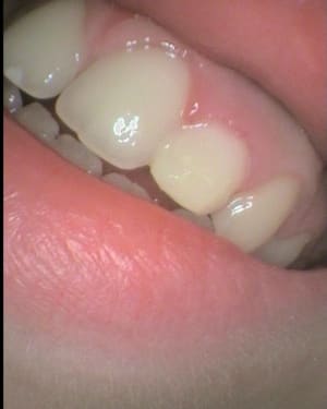 4 fe83r0 - Eugenol
