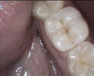 4 qoitw1 - Eugenol