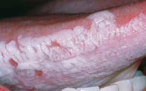4 y7dkhc - Eugenol