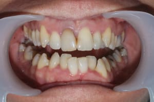 4hd3dgkzsu0bw21ins9du0xn1j63 - Eugenol