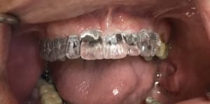 54276f87 ece4 483a a347 21757f96b527 f5ioul - Eugenol