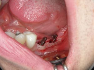 5755 36 pthnhw - Eugenol
