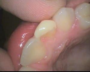 5 b34gdi - Eugenol