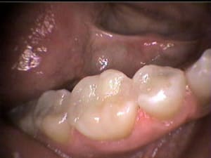68 ra6xon - Eugenol