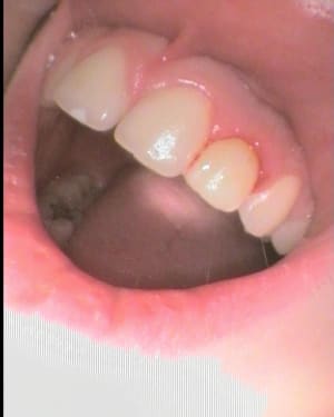 6 a1lpdc - Eugenol