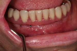 6 jours bis l1l3gw - Eugenol
