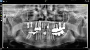 6a7zhir2q18d2fdhmordrqcvdape - Eugenol