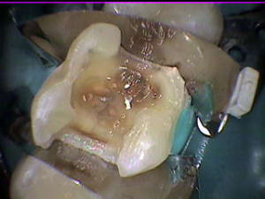 7 26 pdt wsd8u5 - Eugenol