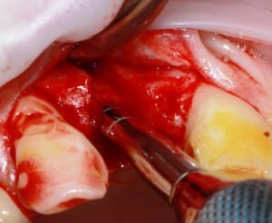 7f6qcwfb045th1sq2f2lk471njms - Eugenol
