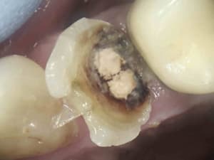 8 tovoto - Eugenol