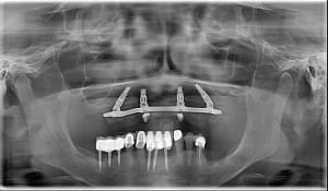 8wr2ypx1cnib26ih54c4e78r6bam - Eugenol