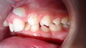 A15 lr7ju6 - Eugenol